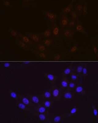 Immunocytochemistry/ Immunofluorescence: Rad23 Antibody (3B7T9) [NBP3-16573]