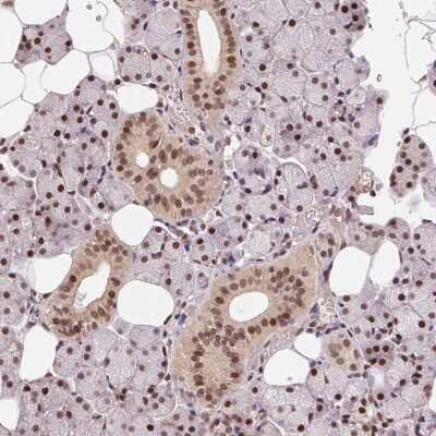 Immunohistochemistry: Rad23 Antibody [NBP2-38072]