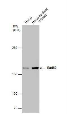 Western Blot: Rad50 Antibody (13B3) [NB100-147]