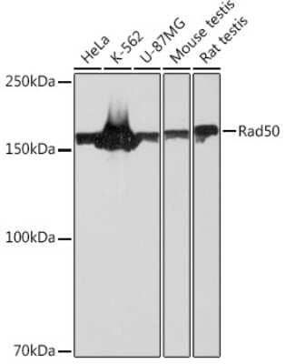 Western Blot: Rad50 Antibody (5M2K10) [NBP3-16286]