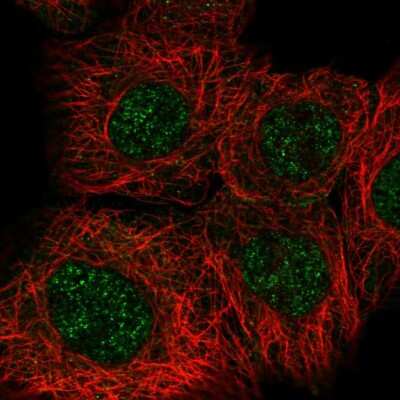 Immunocytochemistry/ Immunofluorescence: Rad50 Antibody [NBP2-47316]