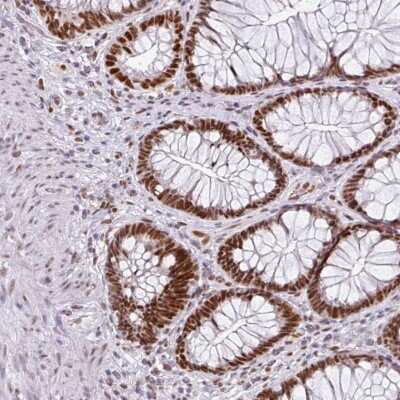 Immunohistochemistry-Paraffin: Rad50 Antibody [NBP2-47316]
