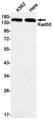 Western Blot: Rad50 Antibody (S05-5H6) [NBP3-19512]