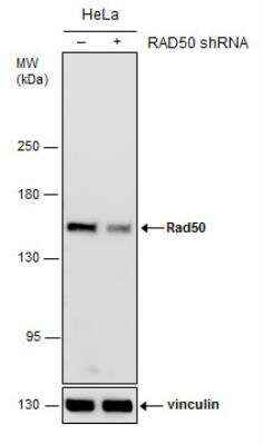 Western Blot: Rad50 Antibody [NBP2-20054]