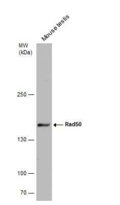 Western Blot: Rad50 Antibody [NBP2-20054]