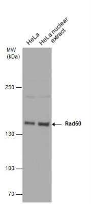 Western Blot: Rad50 Antibody [NBP2-20055]