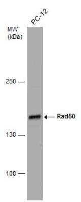 Western Blot: Rad50 Antibody [NBP2-20055]