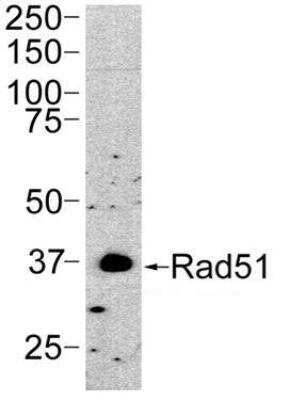 Western Blot: Rad51 Antibody (13E4) [NB100-499]