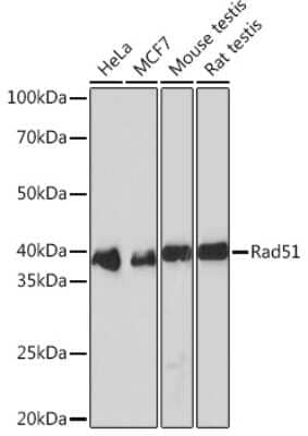 Western Blot: Rad51 Antibody (5S9B0) [NBP3-16149]