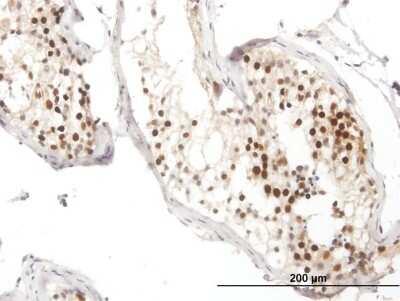 Immunohistochemistry-Paraffin: Rad51 Antibody [H00005888-B01P]