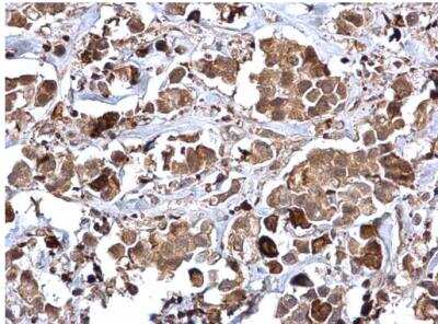 Immunohistochemistry-Paraffin: Rad51 Antibody [NBP2-20058]