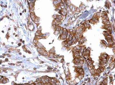Immunohistochemistry-Paraffin: Rad51 Antibody [NBP2-20058]