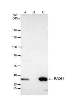 Immunoprecipitation: Rad51 Antibody [NBP2-20058]