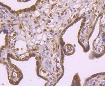 Immunohistochemistry-Paraffin: Rad51 Antibody (JM54-26) [NBP2-75640]