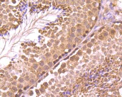 Immunohistochemistry-Paraffin: Rad51 Antibody (JM54-26) [NBP2-75640]