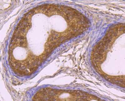 Immunohistochemistry-Paraffin: Rad51 Antibody (JM54-26) [NBP2-75640]