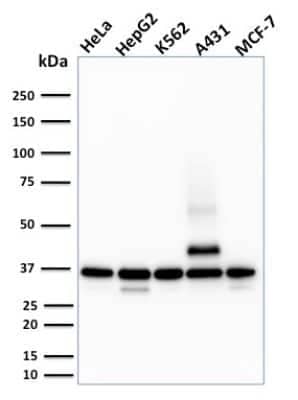 Western Blot: Rad51 Antibody (RAD51/2701)Azide and BSA Free [NBP2-79895]