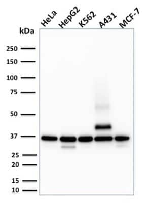 Western Blot: Rad51 Antibody (RAD51/2701) [NBP2-79760]