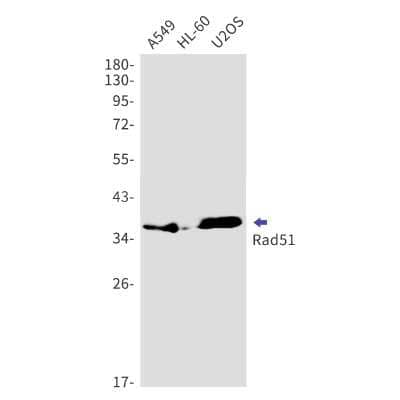 Western Blot: Rad51 Antibody (S04-3C6) [NBP3-14968]