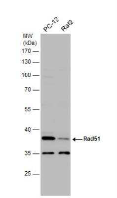 Western Blot: Rad51 Antibody [NBP2-20058]