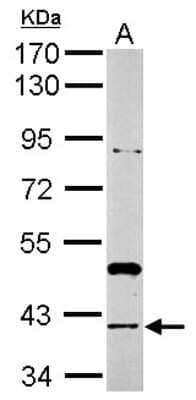 Western Blot: Rad51 Antibody [NBP2-20059]