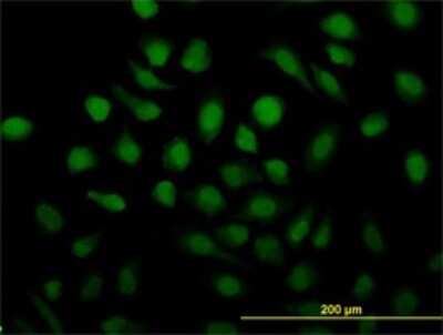 Immunocytochemistry/ Immunofluorescence: Rad51C Antibody (3F3-5C6) [H00005889-M01]