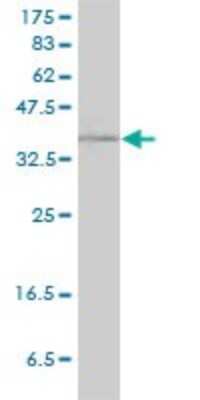 Western Blot: Rad51C Antibody (3F3-5C6) [H00005889-M01]