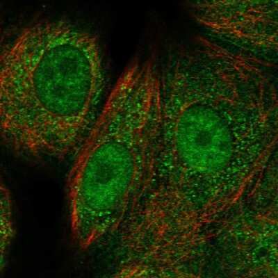 Immunocytochemistry/ Immunofluorescence: Rad51C Antibody [NBP2-55278]