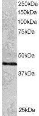 Western Blot: Rad51C Antibody [NB100-1127]