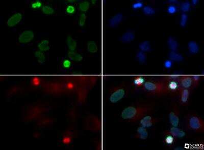 Immunocytochemistry/ Immunofluorescence: Rad51D Antibody (5B3/6) [NB100-178]