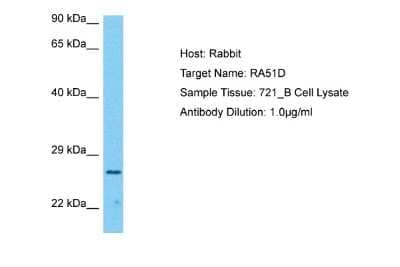 Western Blot: Rad51D Antibody [NBP2-82331]