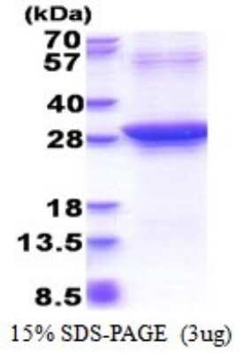 SDS-PAGE: Recombinant Human Rad51D His Protein [NBP2-51524]