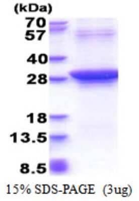 SDS-PAGE: Recombinant Human Rad51D His Protein [NBP2-51524]