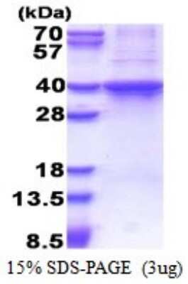SDS-PAGE: Recombinant Human Rad51D His Protein [NBP2-51561]