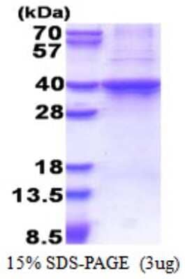 SDS-PAGE: Recombinant Human Rad51D His Protein [NBP2-51561]