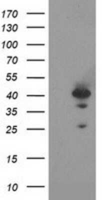 Western Blot: Rad51L1 Antibody (OTI7H4) [NBP2-01220]