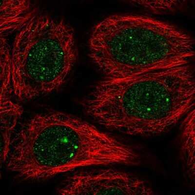 Immunocytochemistry/ Immunofluorescence: Rad51L1 Antibody [NBP2-55046]