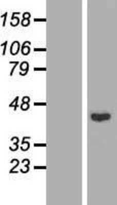 Western Blot: Rad51L1 Overexpression Lysate [NBL1-15120]