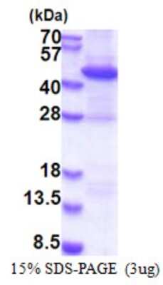 SDS-PAGE: Recombinant Human Rad51L1 His Protein [NBP2-23395]