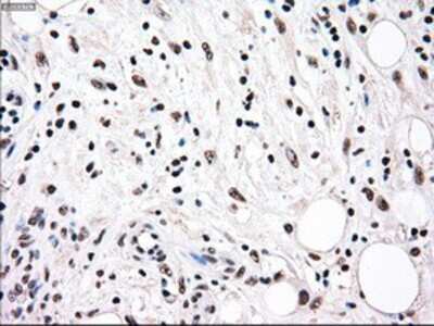 Immunohistochemistry-Paraffin: Rad9 Antibody (OTI7B11) [NBP1-47946]