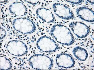 Immunohistochemistry-Paraffin: Rad9 Antibody (OTI7B11) [NBP1-47946]