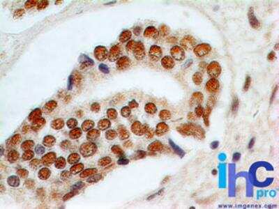 Immunohistochemistry-Paraffin: Rad9 Antibody (93A535) - BSA Free [NB120-13600]