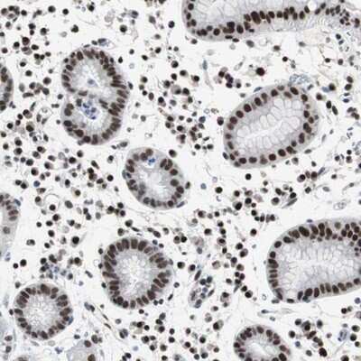 Immunohistochemistry-Paraffin: Rad9 Antibody [NBP1-87163]