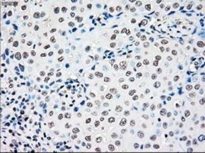 Immunohistochemistry: Rad9 Antibody (OTI7B11) - Azide and BSA Free [NBP2-73783]