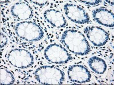 Immunohistochemistry: Rad9 Antibody (OTI7B11) - Azide and BSA Free [NBP2-73783]