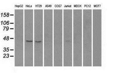 Western Blot: Rad9 Antibody (OTI7B11)Azide and BSA Free [NBP2-73783]