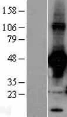 Western Blot: Rad9 Overexpression Lysate [NBL1-15123]