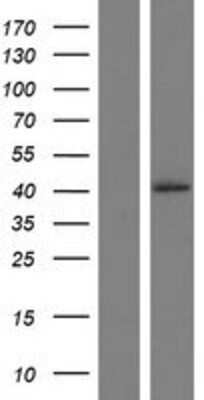 Western Blot: RFNG Overexpression Lysate [NBP2-10855]