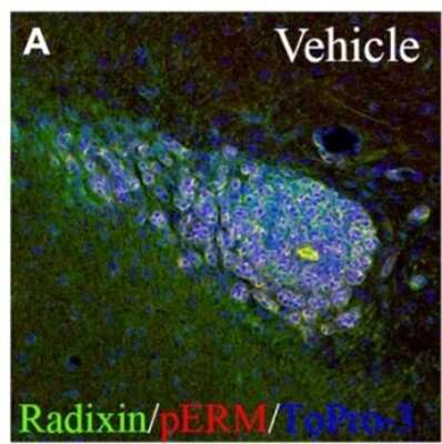 Immunohistochemistry: Radixin Antibody (1D9) [H00005962-M06]