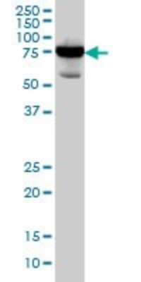 Western Blot: Radixin Antibody (1D9) [H00005962-M06]